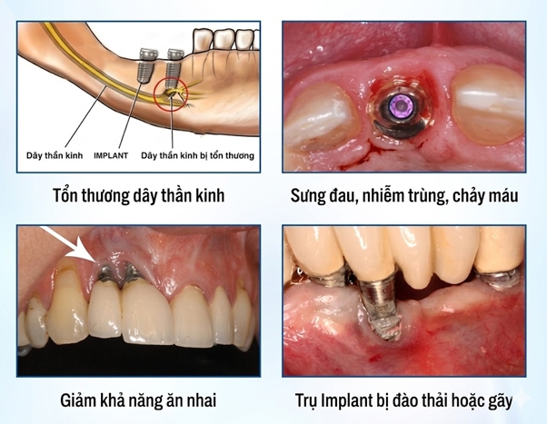 nha khoa lac viet intech  khi cong nghe so khong con la lua chon ma la tieu chuan